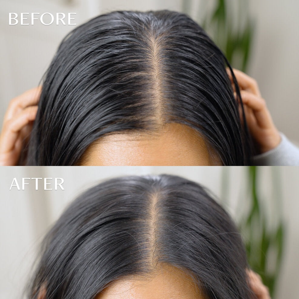 Day After™ Brush + 2 Refills Bundle Clean Dry Shampoo